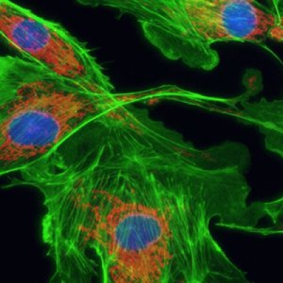 怎么提高顯微鏡的熒光成像的質(zhì)量？